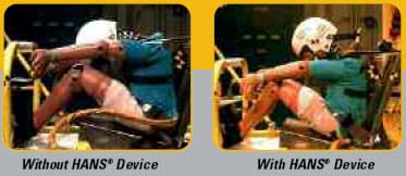 HANSDevice2.jpg
